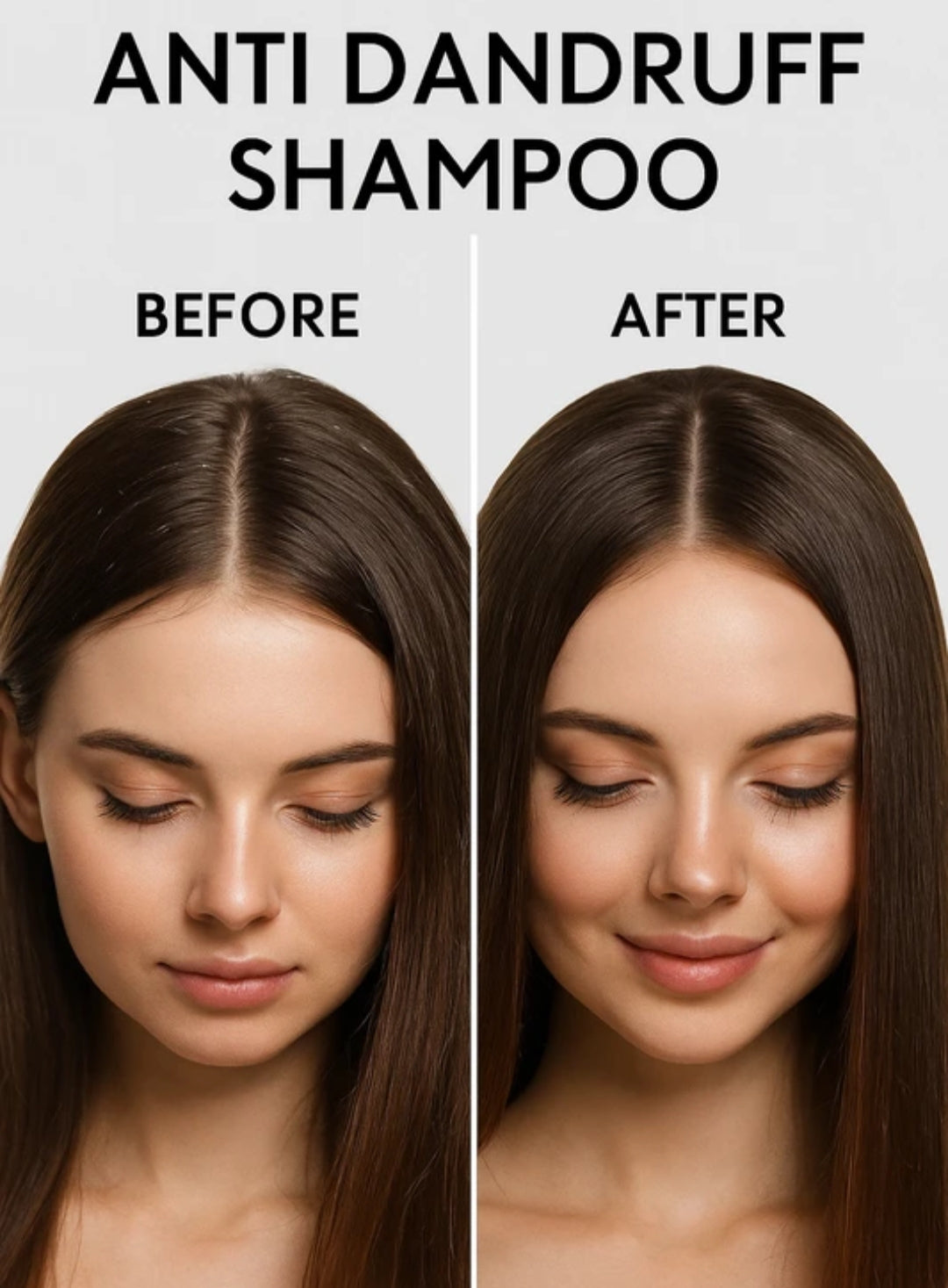 Shampoo and Conditioner- Winyfred Anti Dandruff Shampoo with Korean Formula for Dry and Normal Skin - 250ml