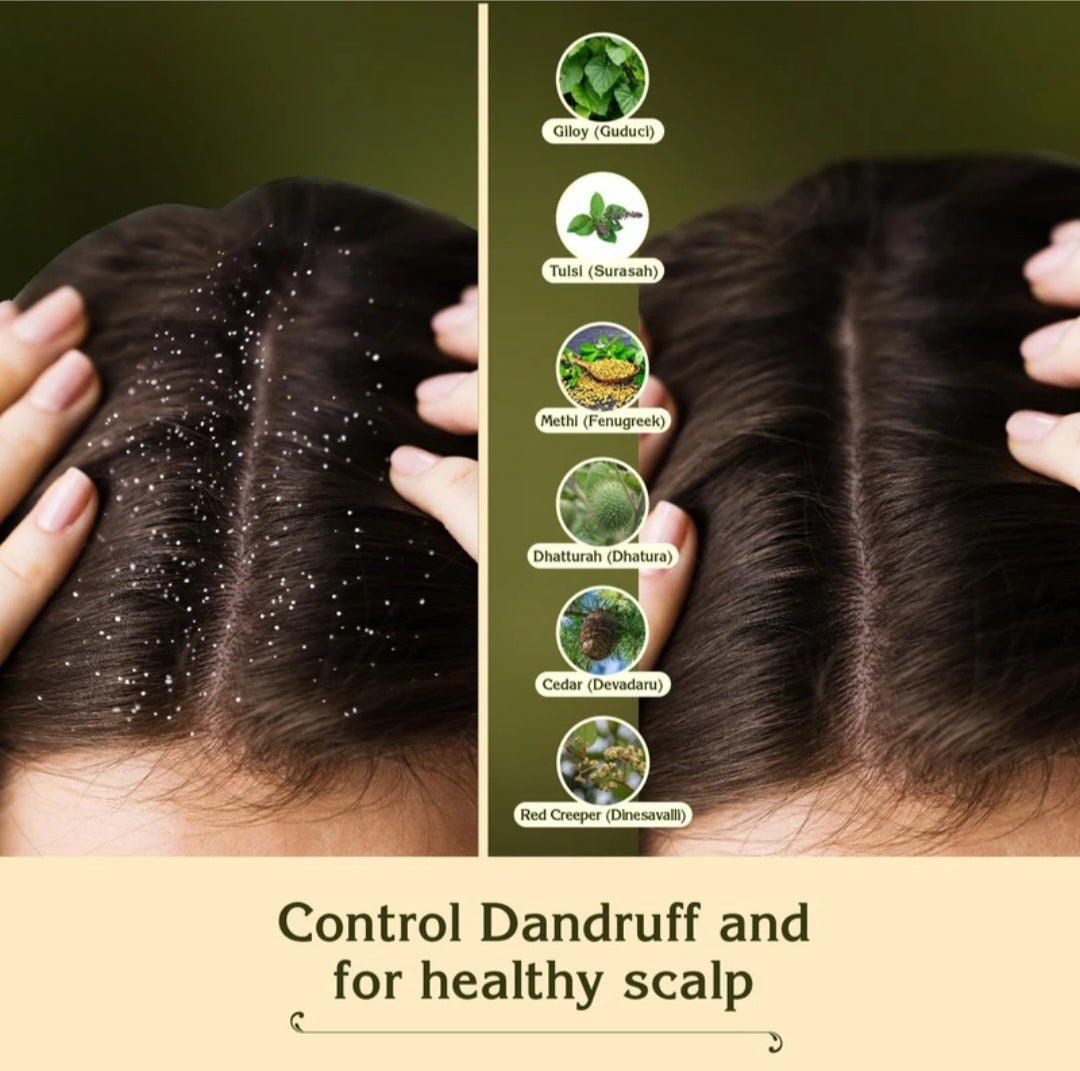 Hair Oil- Chandrika Ayurvedic Hair Oil made with 100% Coconut Oil and 20 Hand-Picked Herbs 190ml
