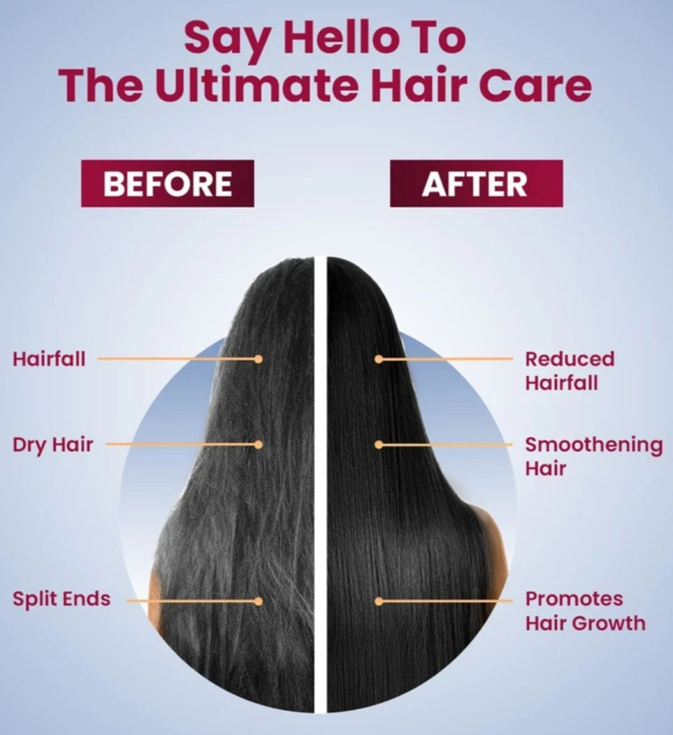 Hair Oil- Parachute Advanced Onion Hair Growth Oil with Natural Coconut Oil, Vitamin-E and Glyceryl Laurate which Nourishes Scalp & Strengthens Root, Reduces Hairfall and Boosts Hair Growth - 200ml