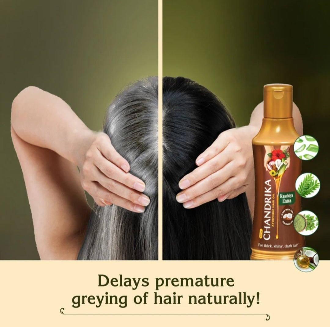 Hair Oil- Chandrika Ayurvedic Hair Oil made with 100% Coconut Oil and 20 Hand-Picked Herbs 190ml